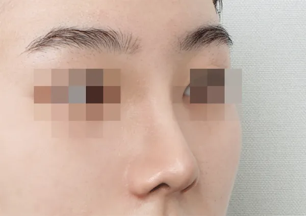 After