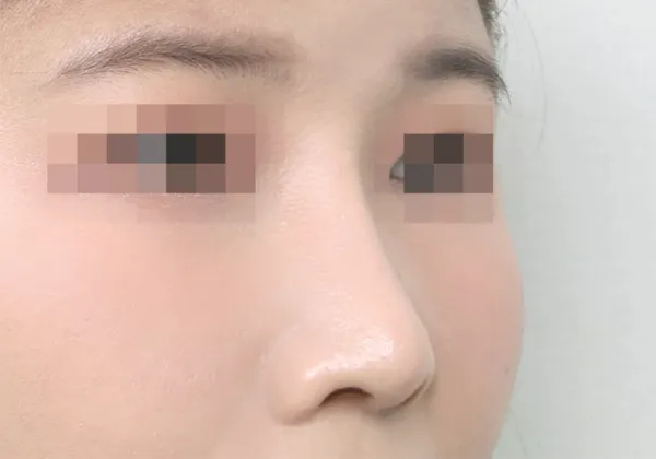 After