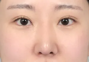 After
