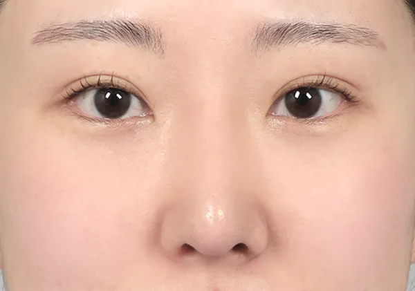 After