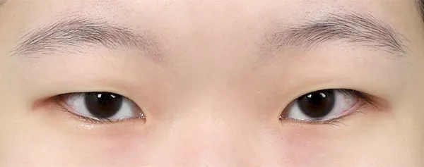 Before