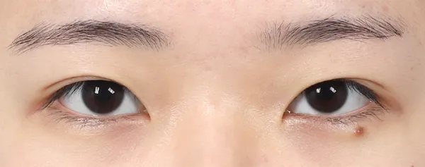 Before