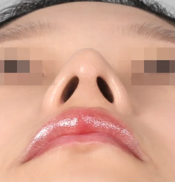 After
