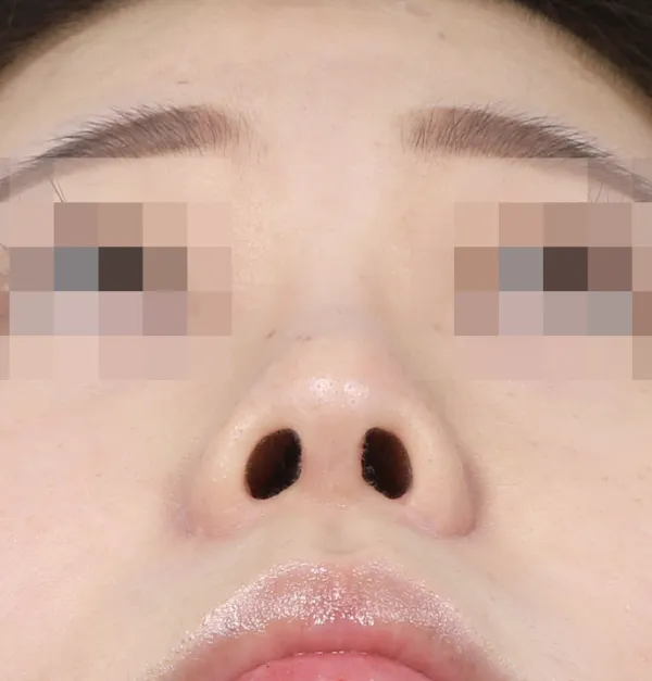 After