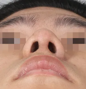 After