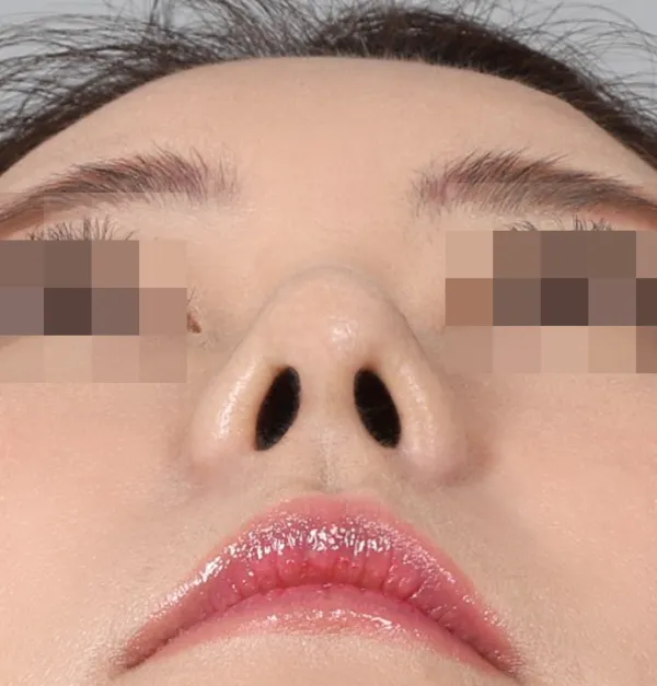 After