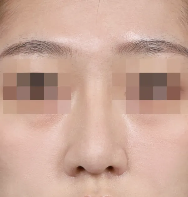 After
