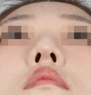 After