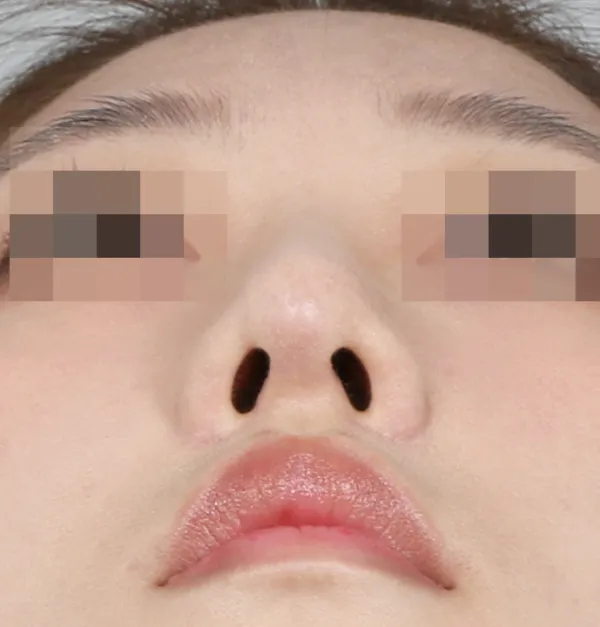 After