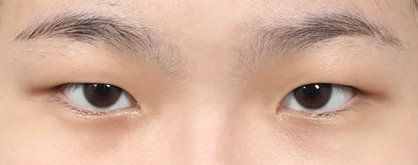 Before