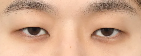 Before