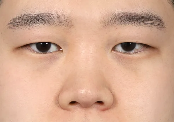 Before