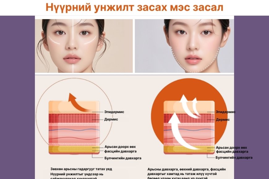 🧠 Нүүрний унжилт – Яагаад зөвхөн арьсыг татах нь хангалтгүй вэ?