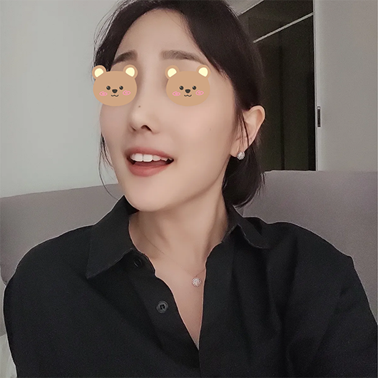 낮은 매부리코 탈출!!!! 성공했어요~