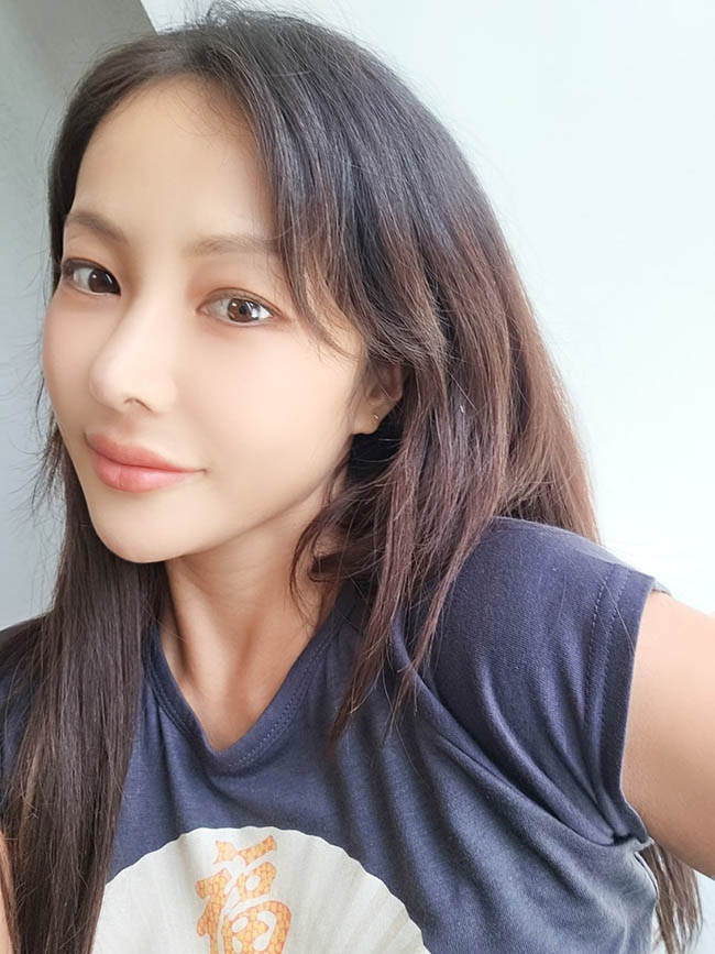 김원장님한테 코재수술 받은 후기S2