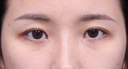 진작에 더 빨리 알아서 했으면 얼마나 좋았을까라는 생각 뿐입니다!