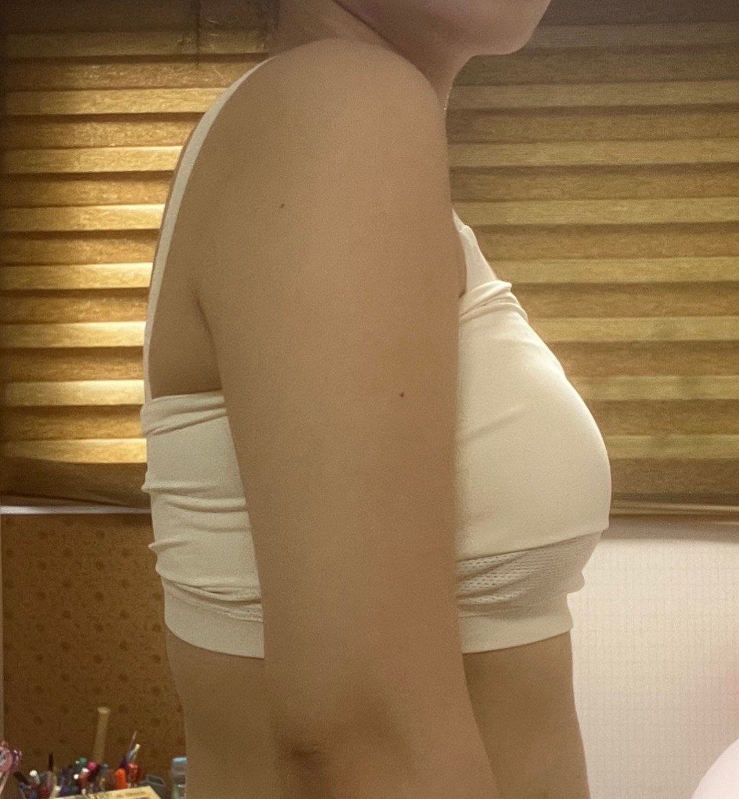 와...진짜 팔 양 옆에 있던 지방들이 그냥 썰렸네요..!너무 만족해요 ㅠㅠㅠ