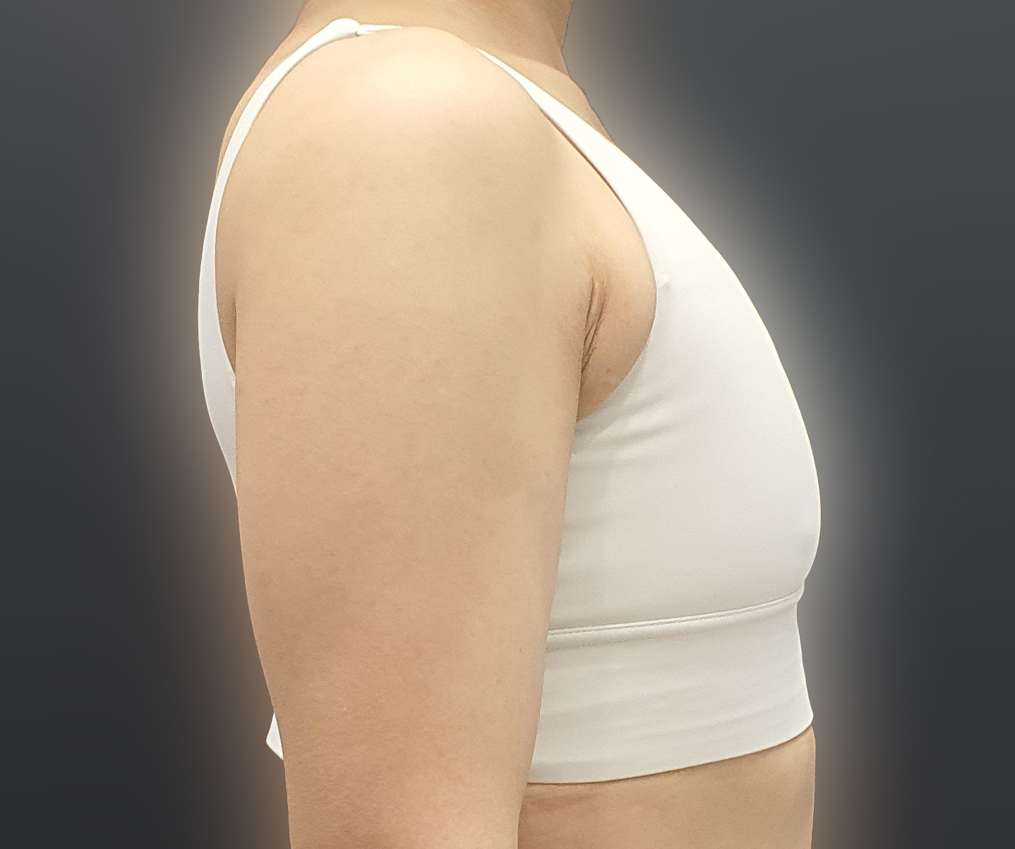 하길 너무 잘했다생각하고 다른부위도 또고민되는곳은 더욕심이난다.