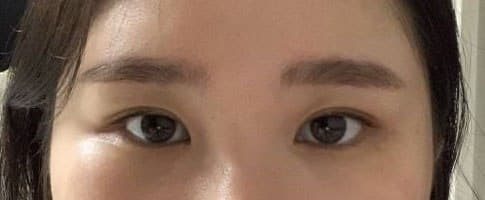 듀얼트임을 하고 완전 만족해요