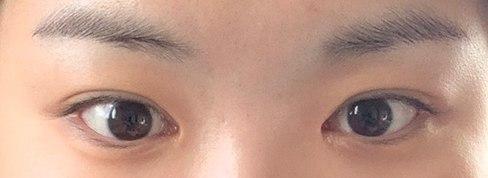 베리굿 쌍수맛집이니까 고민하시는 분들 얼른 방문하세용~!