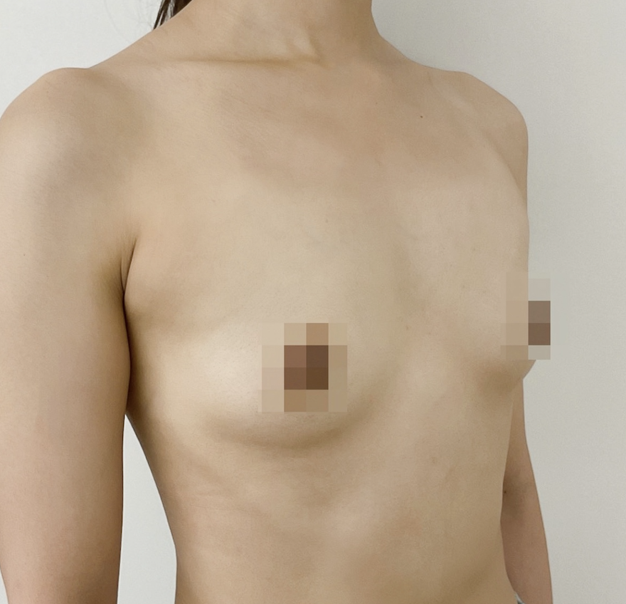 모티바 2달차) 평상복 입었을 때 굉장히 이쁜 사이즈인 것 같아요!