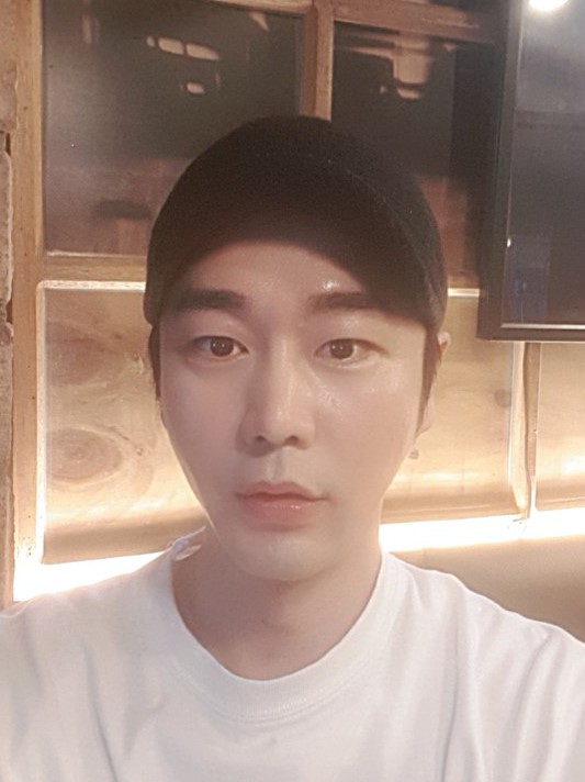 실리프팅과 이마지방이식을 받았어요~