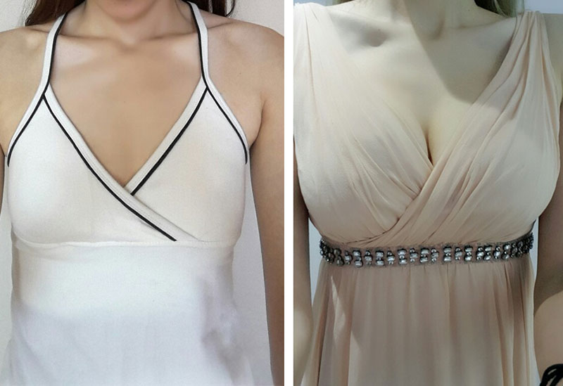 가슴 후기예요~