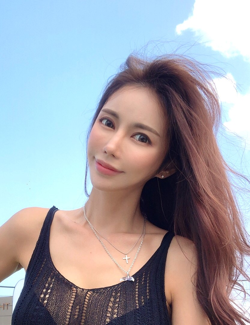 미니안면거상, 지방이식, 지방흡입(볼)