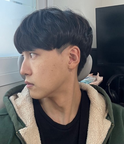 [남자] 븽븽 - 절개눈매교정, 코, 윤곽3종