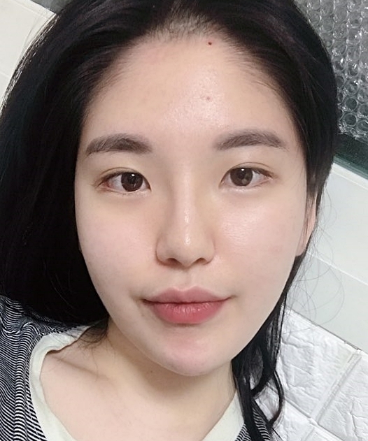 [눈] 산딸기 - 앞트임