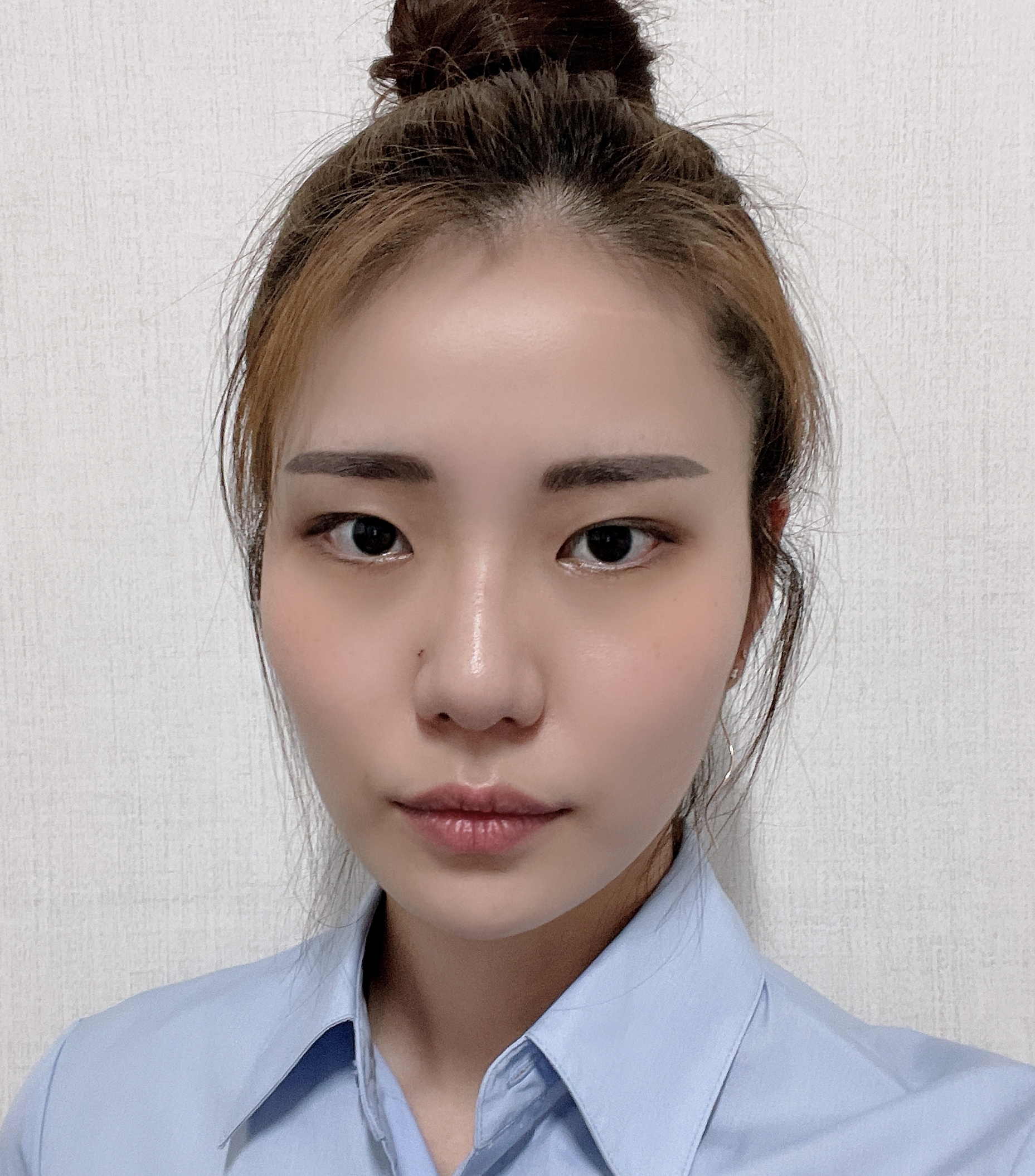 [눈] 빼빼롱 - 비절개눈매교정