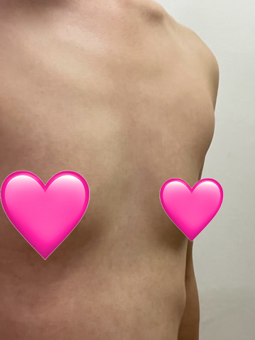 [가슴] 네모빔 - 가슴