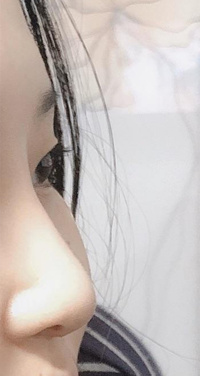 [코] 뚜룰루!! - 코