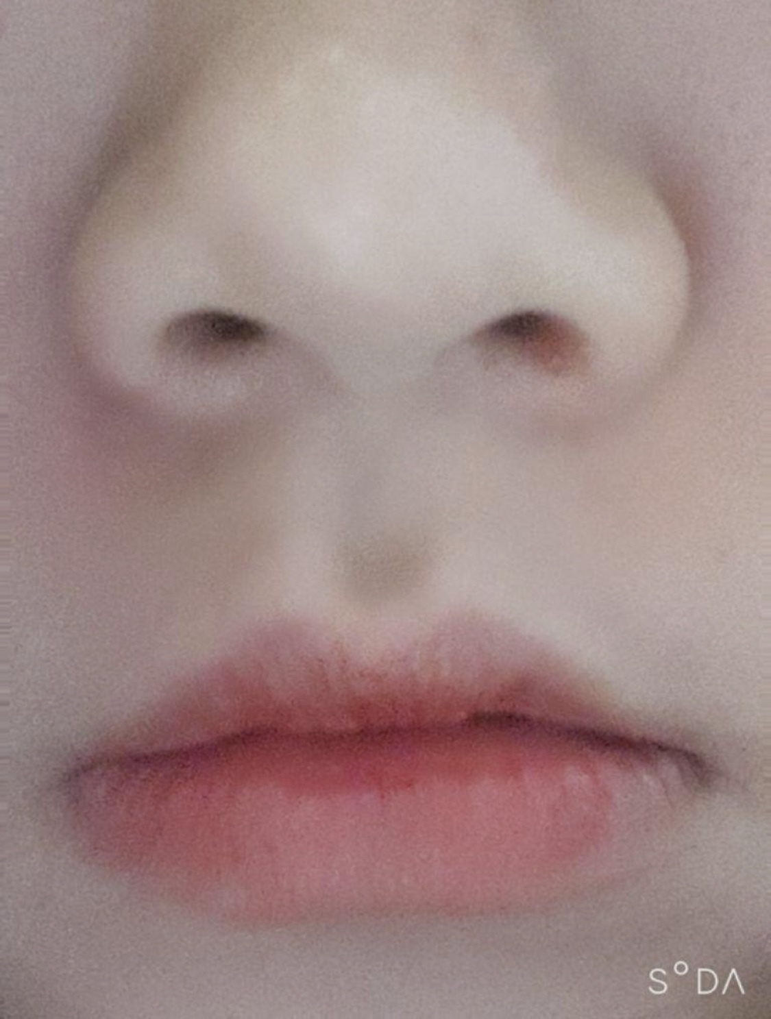 [쁘띠] ds0405 - 보톡스