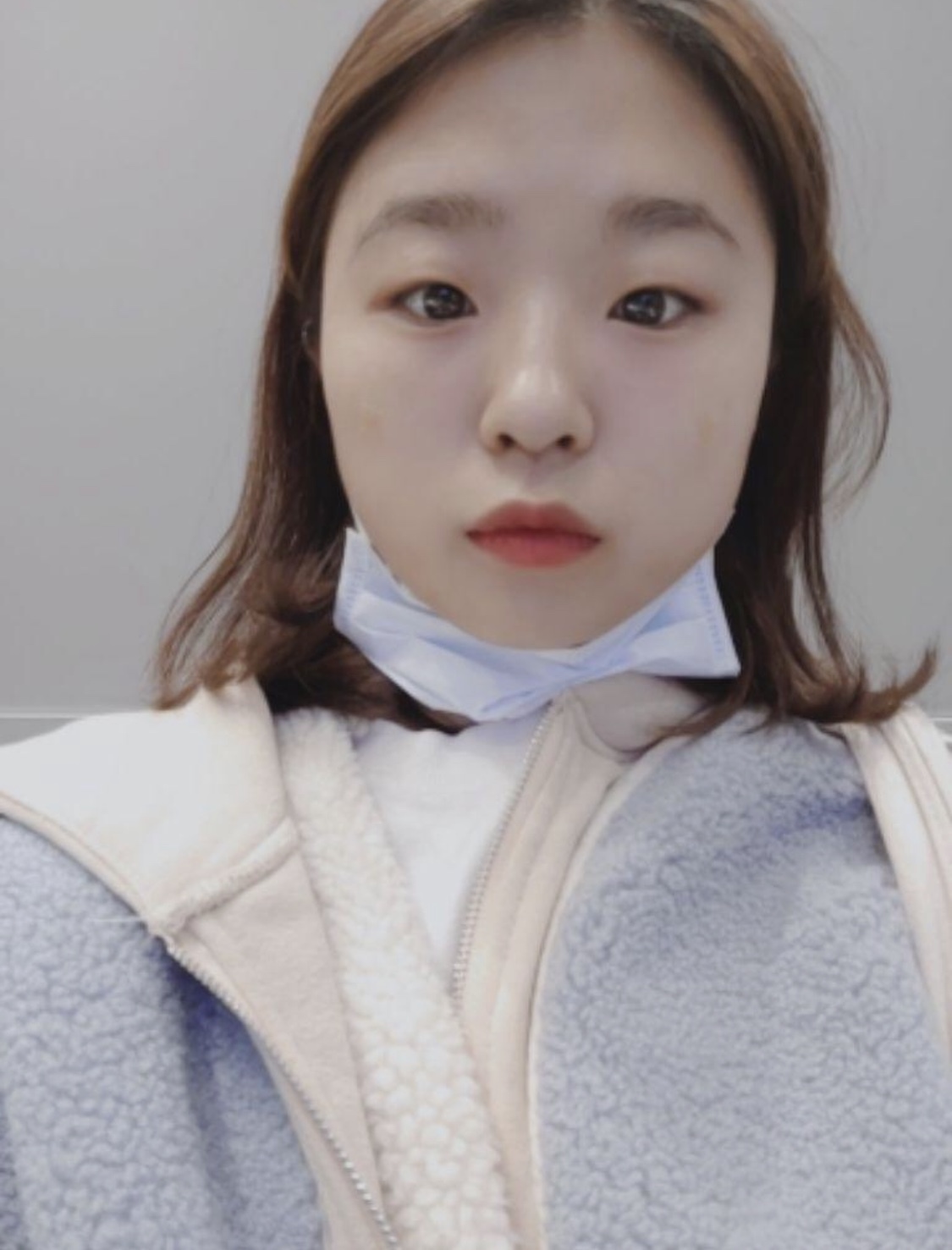 [쁘띠] 힁홍행 - 눈밑,보톡스,필러