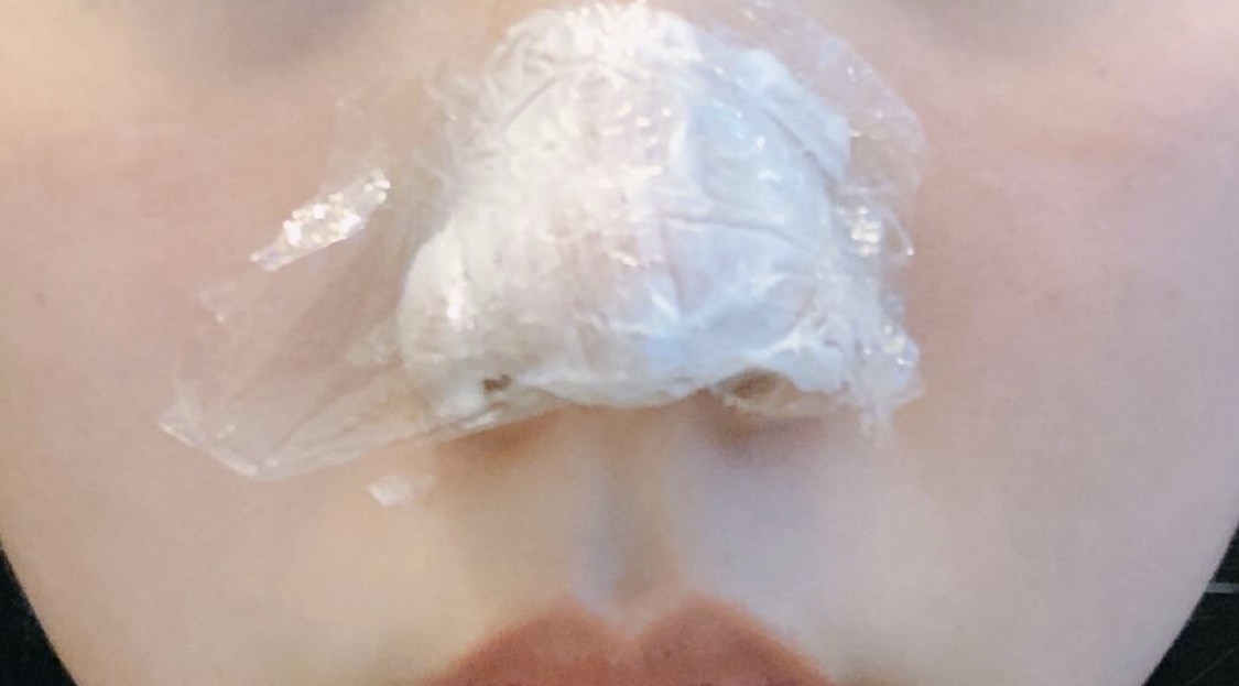 [쁘띠] 프뤼리 - 보톡스,코끝