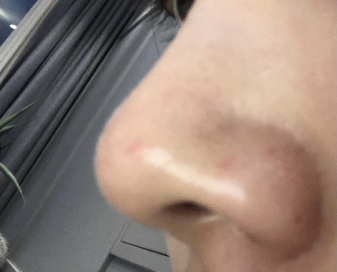 [쁘띠] 민_디 - 코조각주사