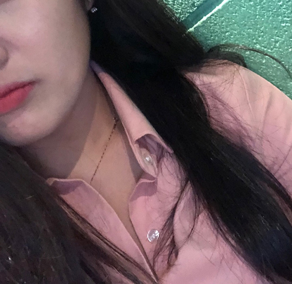 [피부] 배고파30 - 울쎄라리프팅