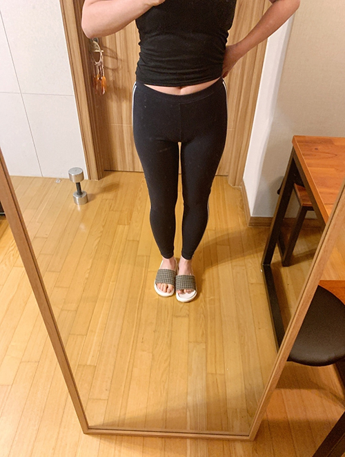 [지방흡입] asura87 - 전신 지방흡입