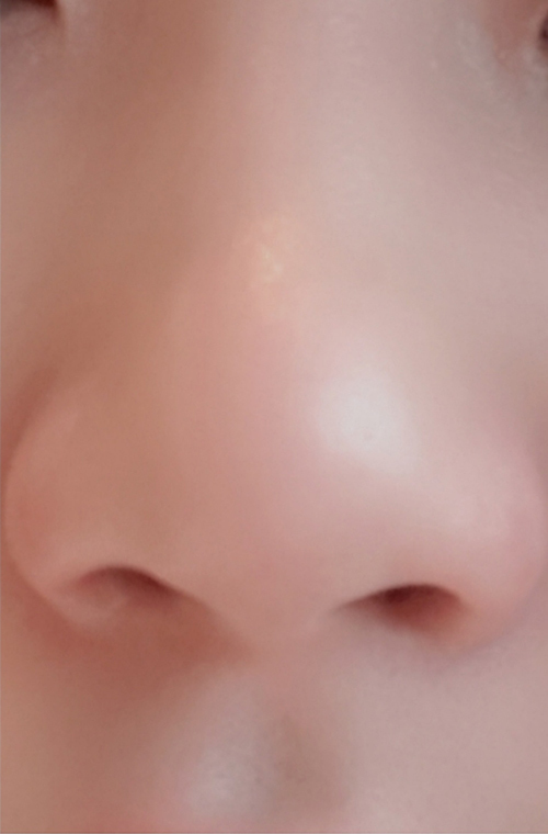 [쁘띠] 7시11분 - 코조각주사