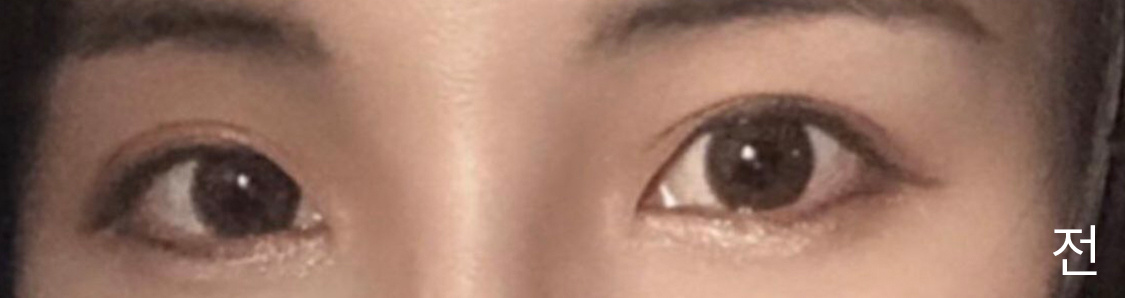 [눈] 트리니티91 - 눈