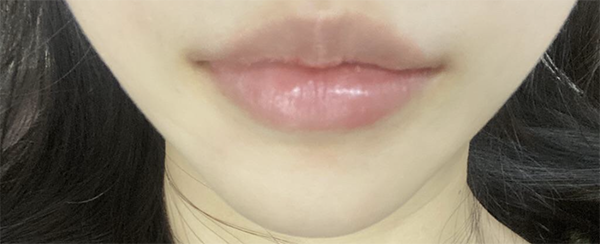 [쁘띠] 히히헣 - 입술