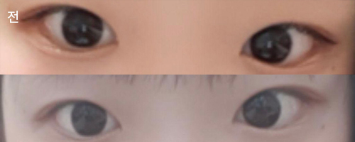 [눈] 신은서입니다 - 눈