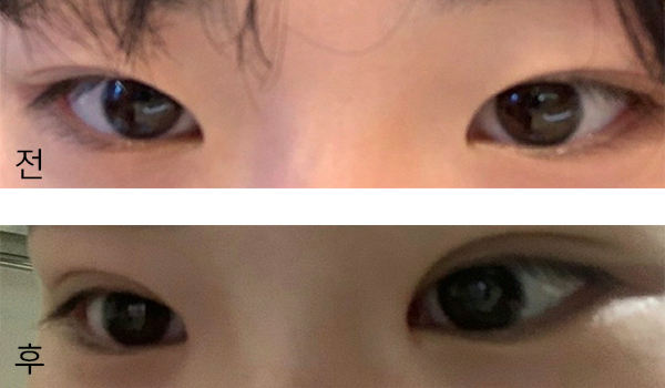 [눈] 쵸키1234 - 눈