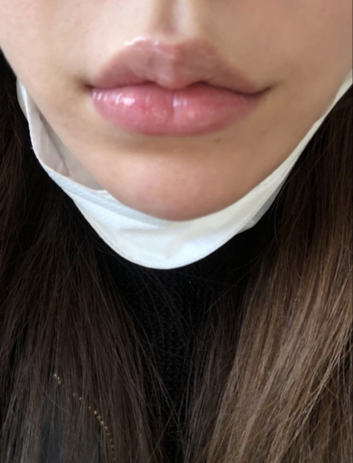 [쁘띠] vvkim - 필러