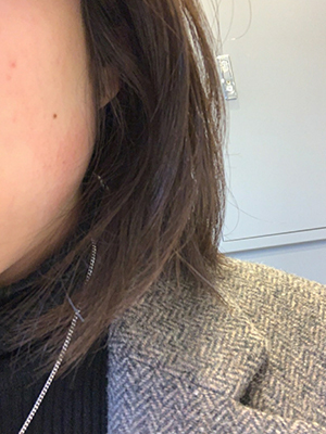 [쁘띠] 멜랑콜리계절 - 턱보톡스