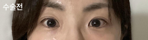 [눈] ㅈㅎㅊ - 눈