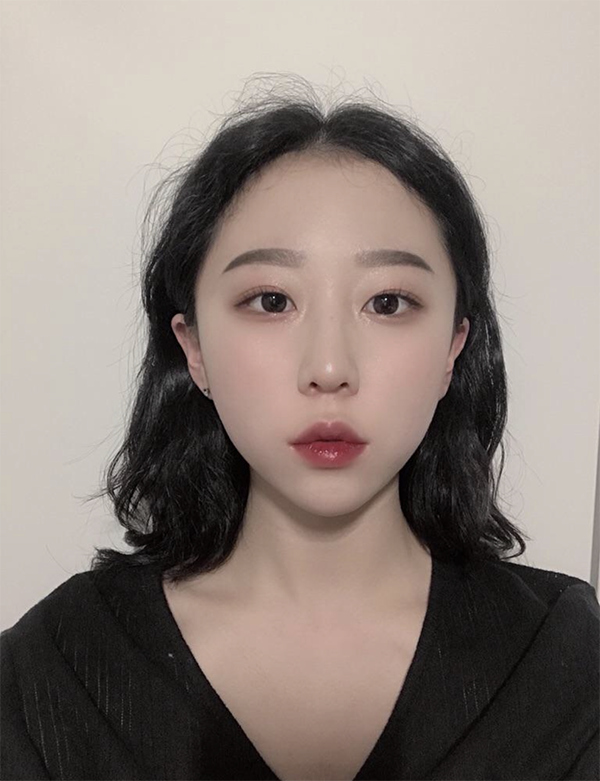 [쁘띠] 야밤의망고스나 - 보톡스, 필러