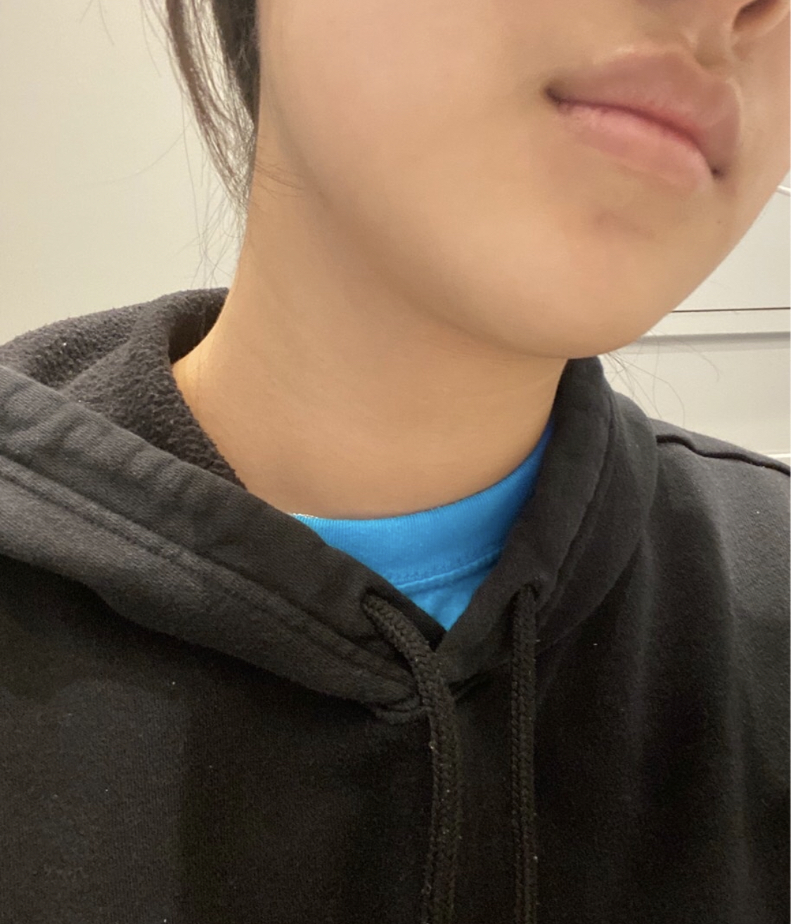 [쁘띠] 뮤임야 - 윤곽주사,슈링크