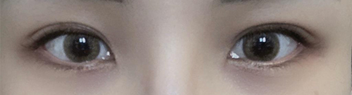 [눈] 트리니티91 - 눈